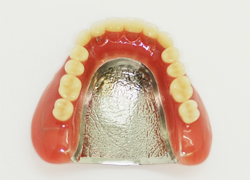 タン床義歯